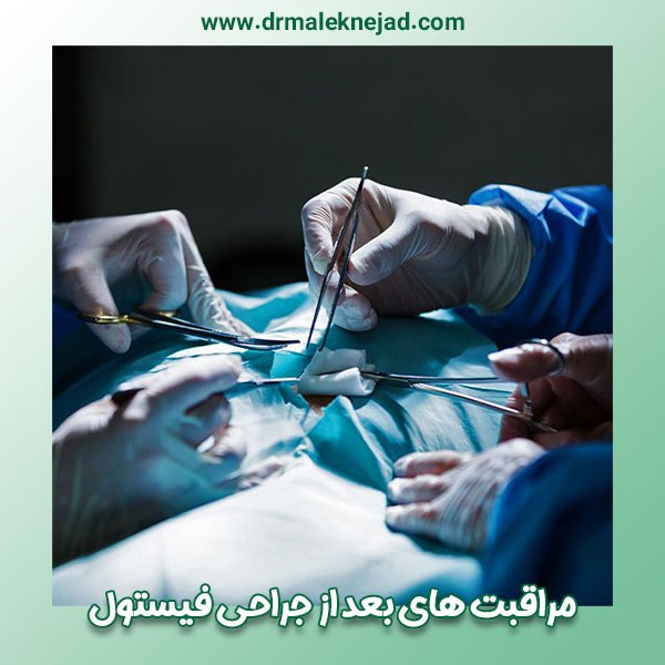 مراقبت های بعد از جراحی فیستول