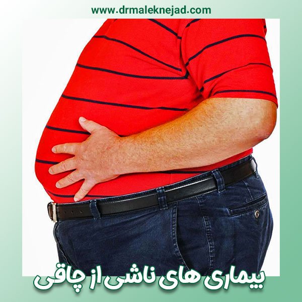 بیماری های ناشی از چاقی