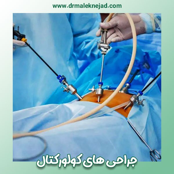 جراحی های کولورکتال