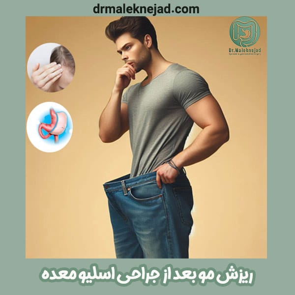 ریزش مو بعد از جراحی اسلیو معده - دکتر ملک نژاد - drmaleknejad.com