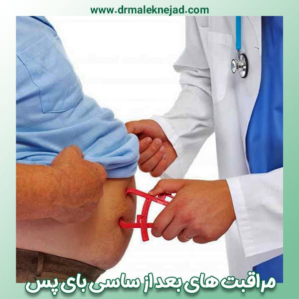 مراقبت های بعد از جراحی ساسی بای پس