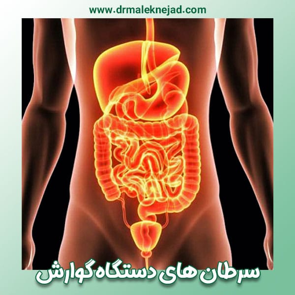 سرطان های دستگاه گوارش