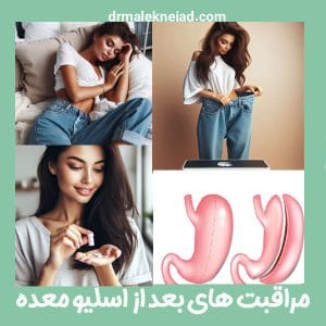 مراقبت های بعد از اسلیو معده - دکتر ملک نژاد - drmaleknejad.com