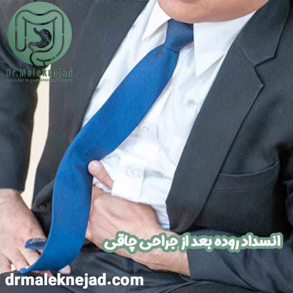 انسداد روده بعد از جراحی چاقی - دکتر عبدالباسط ملک نژاد