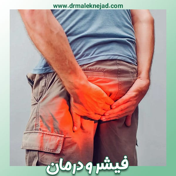 فیشر یا شقاق