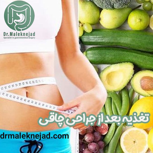تغذیه بعد از جراحی چاقی - پیشگیری از سوء تغذیه بعد از عمل چاقی