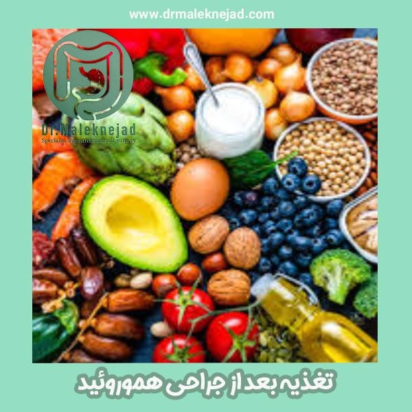 تغذیه بعد از جراحی هموروئید - دکتر ملک نژاد -drmaleknejad.com