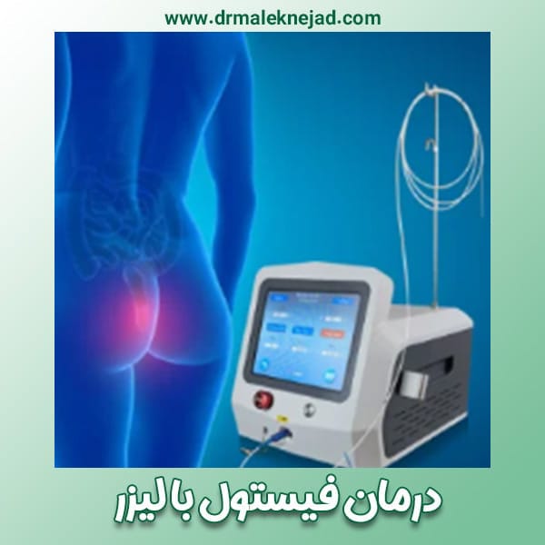 لیزر درمانی فیستول مقعدی - دکتر ملک نژاد-drmaleknejad.com