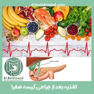 تغذیه بعد از عمل برداشتن کیسه صفرا - دکتر ملک نژاد - drmaleknejad.com