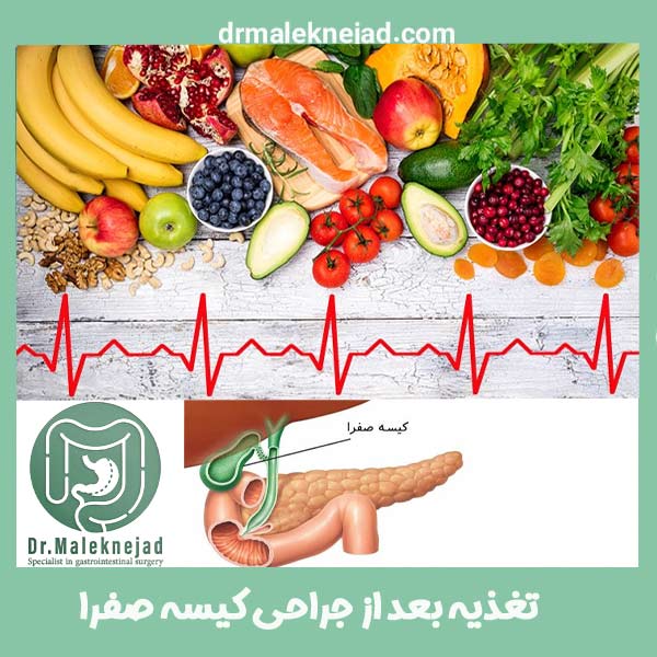 تغذیه بعد از عمل برداشتن کیسه صفرا - دکتر ملک نژاد - drmaleknejad.com