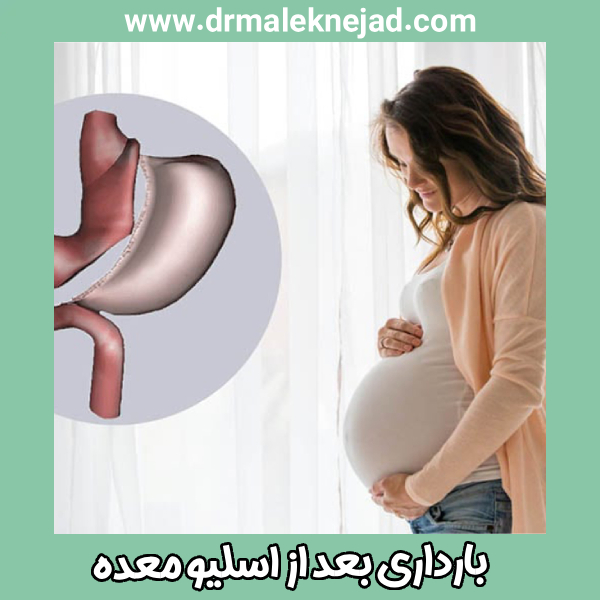 بارداری بعد از اسلیو معده - دکتر عبالباسط ملک نژاد - drmaleknejad.com