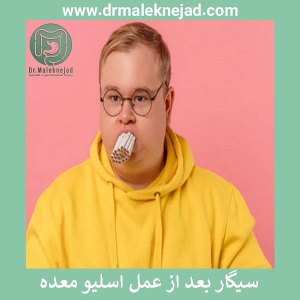 سیگار بعد از عمل اسلیو معده - دکتر عبدالباسط ملک نژاد